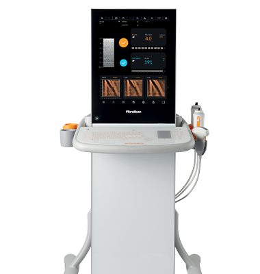 フィブロスキャン630エキスパート | 肝臓検査装置フィブロスキャン