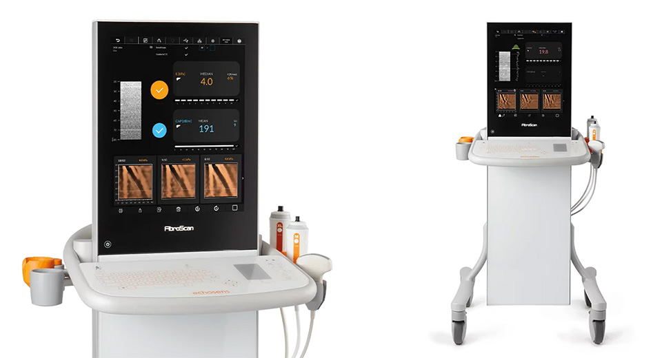 フィブロスキャン630エキスパート | 肝臓検査装置フィブロスキャン
